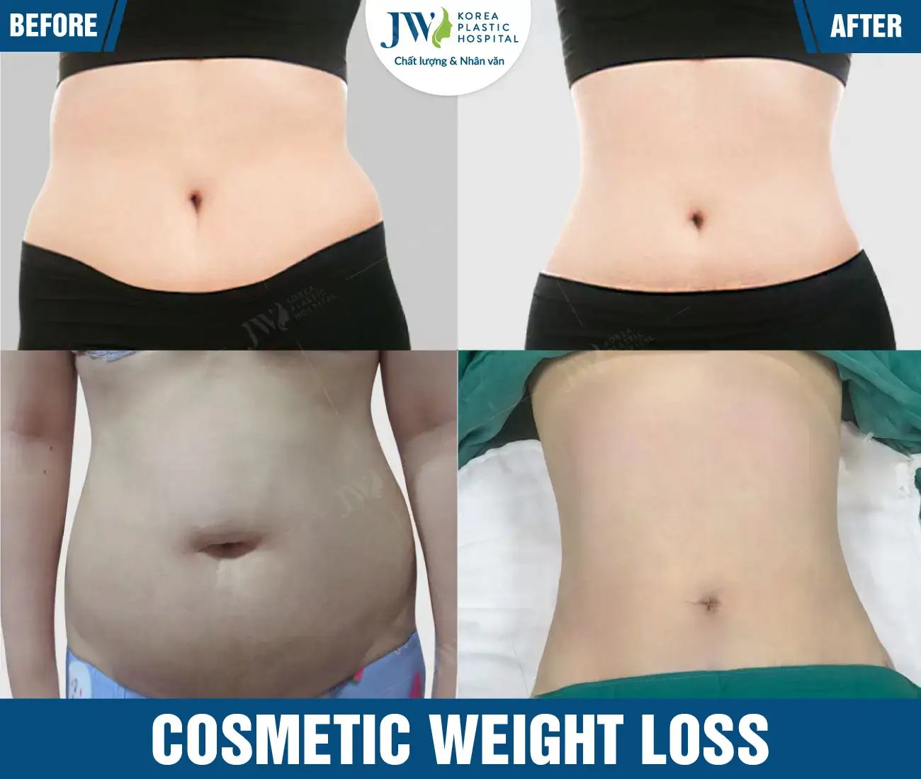 Cosmetic weight loss